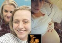 Unikāla operācija: bērnu izņēma no mātes, izoperēja un ievietoja atpakaļ