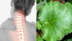 Dadža lapas mazina kakla spondilozes simptomus. Lūk, ko ar tām darīt!