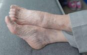 Pensionāre Ogrē staigā plikām kājām, jo veikalā aizliegts pirkt zeķubikses Pensionāre Ogrē staigā plikām kājām, jo veikalā aizliegts pirkt zeķubikses